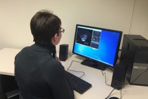 Researcher looking at an ultrasound image